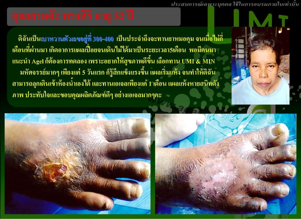 umi-anti-cancer-1024x743